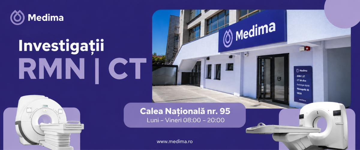 Angio CT membre inferioare cu substanta de contrast